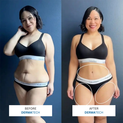 DERMATECH 4 in 1 Sculping Device